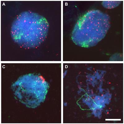 Telomeres and Subtelomeres Dynamics in the Context of Early Chromosome Interactions During Meiosis and Their Implications in Plant Breeding